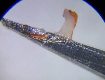 20181208_205524 suture crop low 72 res