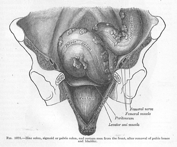 SCAN0009 Sigmoid Colon cropped low resolution